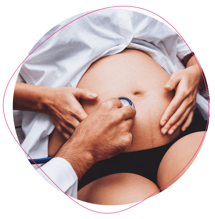 Amniocentesis, a precise diagnostic test providing crucial answers about your baby's health.